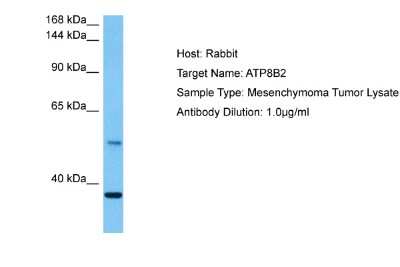 Western Blot: ATP8B2 Antibody [NBP2-87057] - Host: Rabbit. Target Name: ATP8B2. Sample Tissue: Human Mesenchymoma Tumor lysates. Antibody Dilution: 1ug/ml