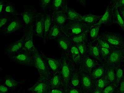 Immunocytochemistry/Immunofluorescence: ATP8B4 Antibody [NBP3-05855] - Staining of ATP8B4 in U2OS cells. Cells were fixed with 4% PFA, permeabilzed with 0.3% Triton X-100 in PBS,blocked with 10% serum, and incubated with rabbit anti-Human ATP8B4 polyclonal antibody (dilution ratio 1:200) at 4? overnight. Then cells were stained with the Alexa Fluor®488-conjugated Goat Anti-rabbit IgG secondary antibody (green). Positive staining was localized to Nucleus and Cytoplasm.