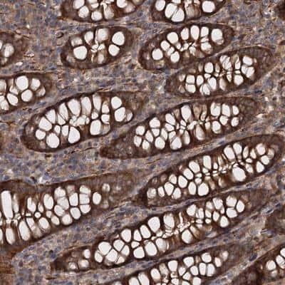 Immunohistochemistry-Paraffin: ATP8B4 Antibody [NBP1-88907] - Staining of human colon shows strong cytoplasmic and membranous positivity in glandular cells.