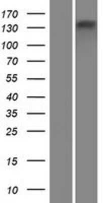 Western Blot: ATP8B4 Overexpression Lysate (Adult Normal) [NBP2-06262] Left-Empty vector transfected control cell lysate (HEK293 cell lysate); Right -Over-expression Lysate for ATP8B4.