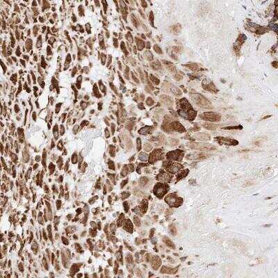 Immunohistochemistry: ATP9B Antibody [NBP1-88906] - Staining of human placenta shows strong cytoplasmic positivity in decidua cells.