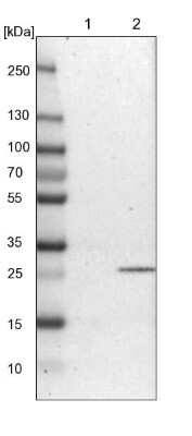 Western Blot: ATPAF2 Antibody [NBP1-88885] - Lane 1: NIH-3T3 cell lysate (Mouse embryonic fibroblast cells). Lane 2: NBT-II cell lysate (Rat Wistar bladder tumor cells).