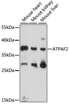 Western Blot: ATPAF2 Antibody [NBP2-92282] - Analysis of extracts of various cell lines, using ATPAF2 at 1000 dilution.Secondary antibody: HRP Goat Anti-Rabbit IgG (H+L) at 1:10000 dilution.Lysates/proteins: 25ug per lane.Blocking buffer: 3% nonfat dry milk in TBST.Detection: ECL Basic Kit .Exposure time: 90s.