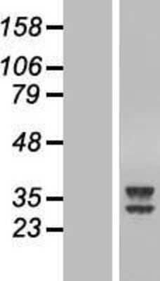 Western Blot: ATPAF2 Overexpression Lysate (Adult Normal) [NBL1-07850] Left-Empty vector transfected control cell lysate (HEK293 cell lysate); Right -Over-expression Lysate for ATPAF2.