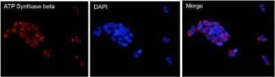 Immunocytochemistry/Immunofluorescence: ATPB Antibody (4.3E8.D10) [NB600-1171] - Analysis of ATP Synthase beta (red) in HEK293T cells. Cells fixed with 4% formaldehyde were permeabilized and blocked with 1X PBS containing 5% BSA and 0.3% Triton X-100 for 1 hour at room temperature. Cells were probed with an ATP Synthase beta monoclonal antibody at a dilution of 1:100 overnight at 4C in 1X PBS containing 1% BSA and 0.3% Triton X-100, washed with 1X PBS, and incubated with a fluorophore-conjugated goat anti-mouse IgG secondary antibody at a dilution of 1:200 for 1 hour at room temperature. Nuclei (blue) were stained with DAPI.