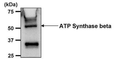 Immunoprecipitation: ATPB Antibody (4.3E8.D10) [NB600-1171] - Analysis of ATP Synthase beta was performed on THP-1 cells. Antigen-antibody complexes were formed by incubating 500ug of THP-1 whole cell lysate (in 500ul volume) with 5ul of an ATP Synthase beta monoclonal antibody overnight at 4C. The immune complexes were captured on 30ul of protein G agarose, washed extensively, and eluted with 6X Laemmli non-reducing sample buffer. Samples were resolved on an 8% SDS-PAGE gel, transferred to a PVDF membrane, and blocked with 5% milk in TBST for 1 hour at room temperature. The membrane was probed with an ATP Synthase beta monoclonal antibody at a dilution of 1:1000 overnight at 4C, washed in TBST, and probed with an HRP-conjugated goat anti-mouse IgG secondary at a dilution of 1:40,000 for 1 hour at room temperature. Chemiluminescent detection was performed using ECL substrate. Data courtesy of the Innovators Program.