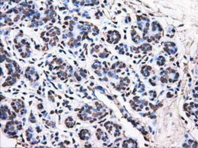 Immunohistochemistry-Paraffin: ATPB Antibody (4E5) [NBP2-02249] - Staining of paraffin-embedded breast tissue using anti-ATPB mouse monoclonal antibody.