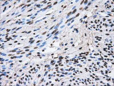 Immunohistochemistry-Paraffin: ATPB Antibody (4E5) [NBP2-02249] - Staining of paraffin-embedded endometrium tissue using anti-ATPB mouse monoclonal antibody.