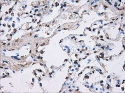 Immunohistochemistry-Paraffin: ATPB Antibody (4E5) [NBP2-02249] - Staining of paraffin-embedded lung tissue using anti-ATPBmouse monoclonal antibody.