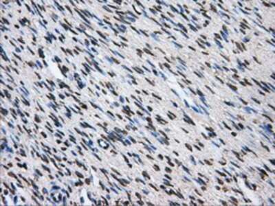 Immunohistochemistry-Paraffin: ATPB Antibody (4E5) [NBP2-02249] - Staining of paraffin-embedded Ovary tissue using anti-ATPB mouse monoclonal antibody.