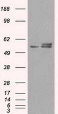 Western Blot: ATPB Antibody (4E5) [NBP2-02249] - HEK293T cells were transfected with the pCMV6-ENTRY control (Left lane) or pCMV6-ENTRY ATPB (Right lane) cDNA for 48 hrs and lysed. Equivalent amounts of cell lysates (5 ug per lane) were separated by SDS-PAGE and immunoblotted with anti-ATPB.