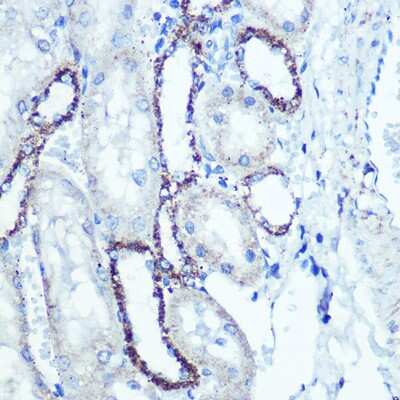 Immunohistochemistry-Paraffin: ATPB Antibody (9A1O2) [NBP3-15354] - Immunohistochemistry of paraffin-embedded rat kidney using ATPB Rabbit mAb (NBP3-15354) at dilution of 1:100 (40x lens).Perform microwave antigen retrieval with 10 mM PBS buffer pH 7.2 before commencing with IHC staining protocol.