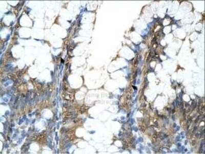 Immunohistochemistry-Paraffin: ATPB Antibody [NBP1-54700] - Human Intestine Epithelial cells of intestinal villus (Indicated with Arrows).