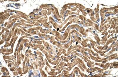 Immunohistochemistry-Paraffin: ATPB Antibody [NBP1-54700] - Human Muscle Tissue, Skeletal muscle cells (Indicated with Arrows) 4-8ug/ml.