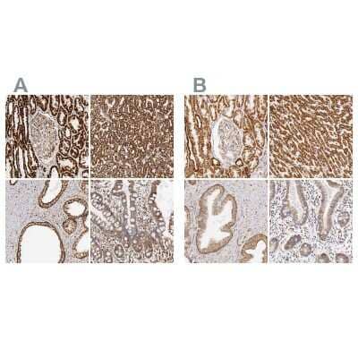 <b>Independent Antibodies Validation. </b>Immunohistochemistry-Paraffin: ATPB Antibody [NBP1-90815] - Staining of human kidney, liver, prostate and small intestine using Anti-ATP5B antibody NBP1-90815 (A) shows similar protein distribution across tissues to independent antibody NBP1-90816 (B).