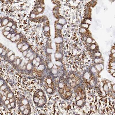 Immunohistochemistry-Paraffin: ATPB Antibody [NBP1-90815] - Staining of human small intestine shows moderate granular cytoplasmic positivity in glandular cells.