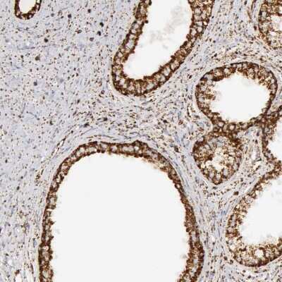 Immunohistochemistry-Paraffin: ATPB Antibody [NBP1-90815] - Staining of human prostate shows strong granular cytoplasmic positivity in glandular cells.