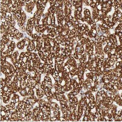 Immunohistochemistry-Paraffin: ATPB Antibody [NBP1-90815] - Staining of human liver shows strong granular cytoplasmic positivity in hepatocytes