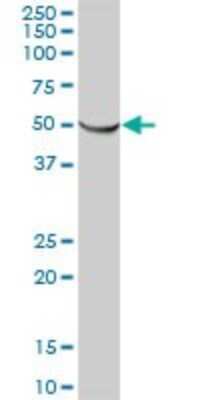 Western Blot: ATPB Antibody [H00000506-B01P] - Analysis of ATP5B expression in human liver.