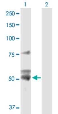 Western Blot: ATPB Antibody [H00000506-D01P] - Analysis of ATP5B expression in transfected 293T cell line by ATP5B polyclonal antibody.Lane 1: ATP5B transfected lysate(56.60 KDa).Lane 2: Non-transfected lysate.