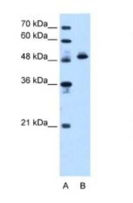 Western Blot: ATPB Antibody [NBP1-54700] - ATP5B antibody - N-terminal region validated by WB using HepG2 cell lysate at 1.25ug/ml.