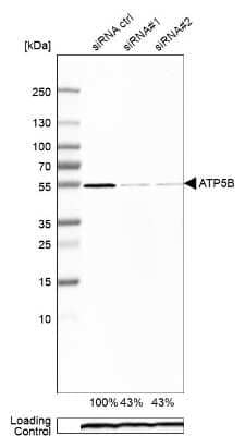 <b>Genetic Strategies Validation. </b>Western Blot: ATPB Antibody [NBP1-90815] - Analysis in A-549 cells transfected with control siRNA, target specific siRNA probe #1 and #2, using Anti-ATP5B antibody. Remaining relative intensity is presented. Loading control: Anti-PPIB.