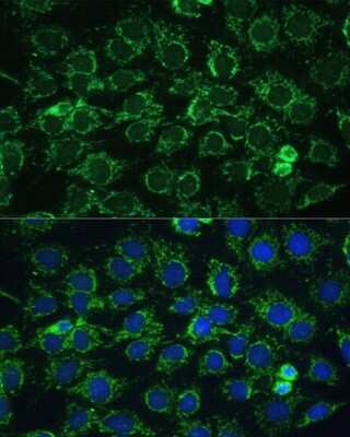 Immunocytochemistry/Immunofluorescence: ATPG Antibody [NBP2-92867] - Analysis of C6 cells using ATPG . Blue: DAPI for nuclear staining.