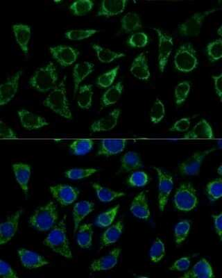 Immunocytochemistry/Immunofluorescence: ATPG Antibody [NBP2-92867] - Analysis of L929 cells using ATPG . Blue: DAPI for nuclear staining.