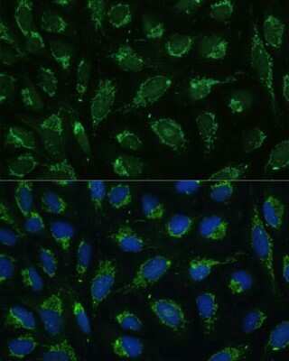 Immunocytochemistry/Immunofluorescence: ATPG Antibody [NBP2-92867] - Analysis of U-2 OS cells using ATPG . Blue: DAPI for nuclear staining.