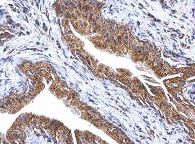 Immunohistochemistry-Paraffin: ATPG Antibody [NBP2-15525] -  Paraffin-embedded mouse urinary bladder.  ATP synthase gamma antibody dilution: 1:500.