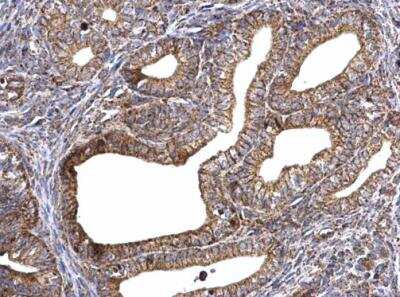 Immunohistochemistry-Paraffin: ATPG Antibody [NBP2-15525] - Paraffin-embedded mouse cervix.  ATP synthase gamma antibody dilution: 1:500.