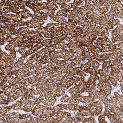 Immunohistochemistry-Paraffin: ATPG Antibody [NBP2-34138] - Staining of human liver shows strong cytoplasmic positivity in hepatocytes.