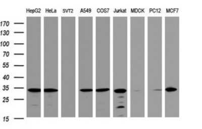 Western Blot: ATPG Antibody (OTI2H6) - Azide and BSA Free [NBP2-70233] - Analysis of extracts (35ug) from 9 different cell lines (HepG2: human; HeLa: human; SVT2: mouse; A549: human; COS7: monkey; Jurkat: human; MDCK: canine; PC12: rat; MCF7: human).