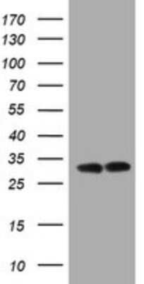 Western Blot: ATPG Antibody (OTI2H6) - Azide and BSA Free [NBP2-70233] - Analysis of HEK293T cells were transfected with the pCMV6-ENTRY control (Left lane) or pCMV6-ENTRY ATPG.