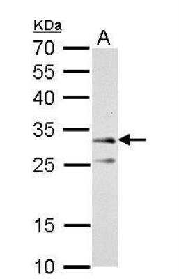 Western Blot: ATPG Antibody [NBP2-15525] - A. 50 ug rat kidney lysate/extract 12% SDS-PAGE ATP synthase gamma antibody dilution: 1:5000  The HRP-conjugated anti-rabbit IgG antibody (NBP2-19301) was used to detect the primary antibody.