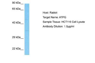 Western Blot: ATPG Antibody [NBP2-87059] - Host: Rabbit. Target Name: ATPG. Sample Type: HCT116 Whole Cell lysates. Antibody Dilution: 1.0ug/ml