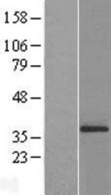 Western Blot: ATPG Overexpression Lysate (Adult Normal) [NBL1-07818] Left-Empty vector transfected control cell lysate (HEK293 cell lysate); Right -Over-expression Lysate for ATPG.