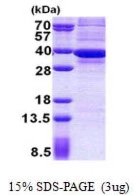 SDS-PAGE Recombinant Human ATPG His Protein