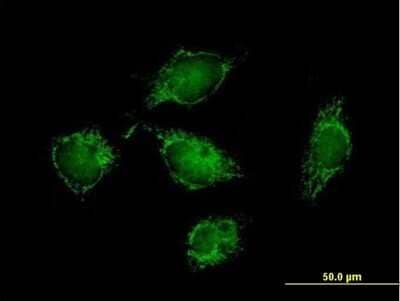 Immunocytochemistry/Immunofluorescence: ATPase Inhibitory Factor 1 Antibody [H00093974-B01P] - Analysis of purified antibody to ATPIF1 on HeLa cell. (antibody concentration 10 ug/ml)