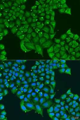 Immunocytochemistry/Immunofluorescence: ATPase Inhibitory Factor 1 Antibody [NBP2-92891] - Analysis of U2OS cells using ATPase Inhibitory Factor 1 at dilution of 1:100. Blue: DAPI for nuclear staining.