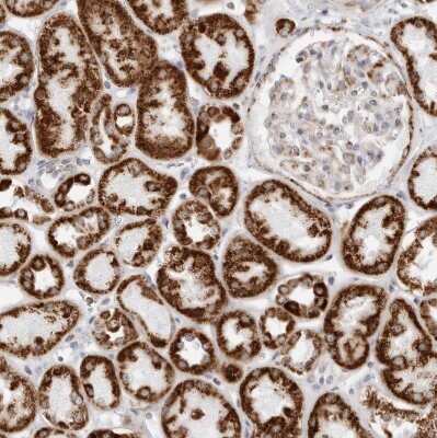 Immunohistochemistry-Paraffin: ATPase Inhibitory Factor 1 Antibody [NBP1-90069] - Staining of human kidney shows strong cytoplasmic granular positivity in cells in tubules.