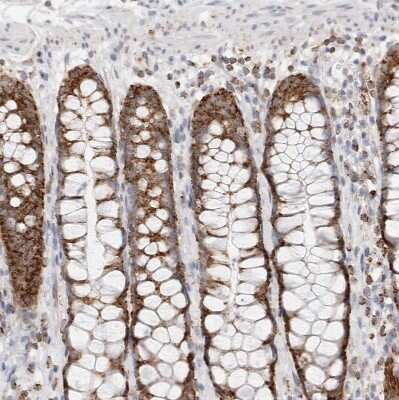 Immunohistochemistry-Paraffin: ATPase Inhibitory Factor 1 Antibody [NBP1-90069] - Staining of human rectum shows strong cytoplasmic granular positivity in glandular cells.