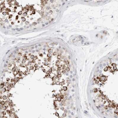 Immunohistochemistry-Paraffin: ATPase Inhibitory Factor 1 Antibody [NBP1-90069] - Staining of human testis shows strong cytoplasmic granular positivity in cells in seminiferous ducts.