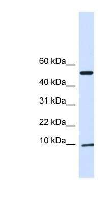 Western Blot: ATPase Inhibitory Factor 1 Antibody [NBP1-79284] - 293T cells lysate, concentration 0.2-1 ug/ml.