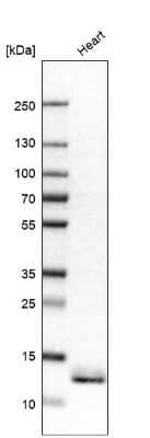 Western Blot ATPase Inhibitory Factor 1 Antibody