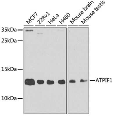 Western Blot: ATPase Inhibitory Factor 1 Antibody [NBP2-92891] - Analysis of extracts of various cell lines, using ATPase Inhibitory Factor 1 at 1:1000 dilution.Secondary antibody: HRP Goat Anti-Rabbit IgG (H+L) at 1:10000 dilution.Lysates/proteins: 25ug per lane.Blocking buffer: 3% nonfat dry milk in TBST.Detection: ECL Basic Kit .Exposure time: 90s.