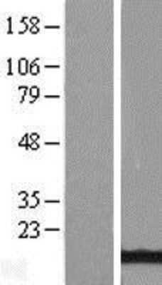 Western Blot ATPase Inhibitory Factor 1 Overexpression Lysate