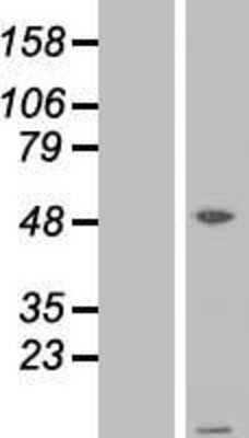 Western Blot ATPase Inhibitory Factor 1 Overexpression Lysate