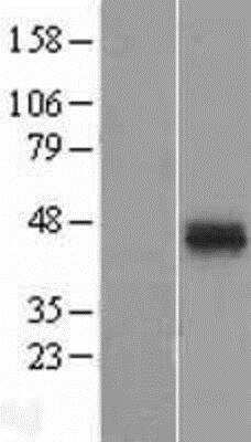 Western Blot: ATPase Na+/K+ beta 2 Overexpression Lysate (Native) [NBP2-10893] - ATPase Na+/K+ beta 2 Overexpression Lysate (Native) Left-Empty vector transfected control cell lysate (HEK293 cell lysate); Right -Over-expression Lysate for ATPase Na+/ K+ beta 2.