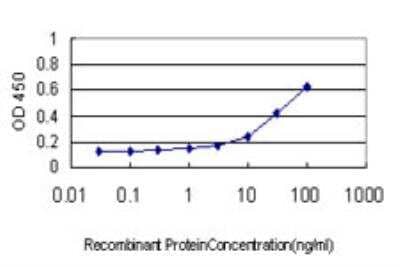 ELISA: ATPase Na+/K+ beta 3 Antibody (2F5) [H00000483-M06] - Detection limit for recombinant GST tagged ATP1B3 is approximately 1ng/ml as a capture antibody.